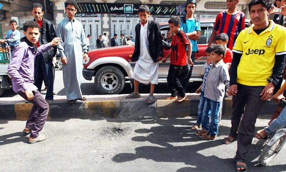 Twin Sanaa blasts wound 20