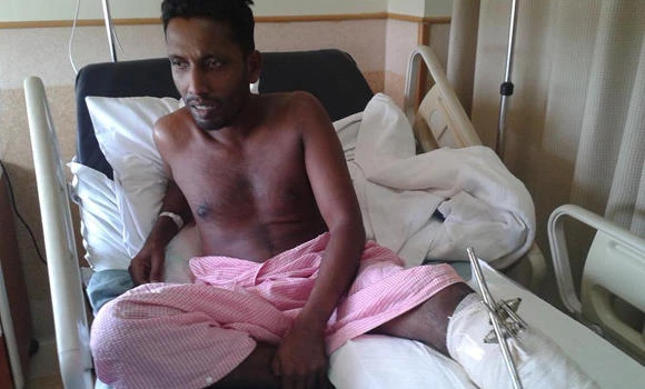 Expat seeks compensation for lost limb in the line of duty