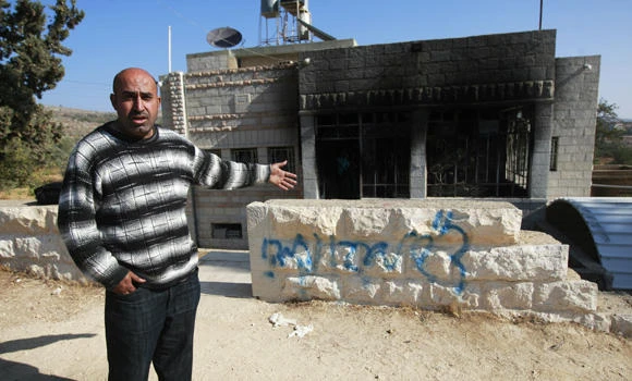 Palestinian children hurt in Jewish revenge attack