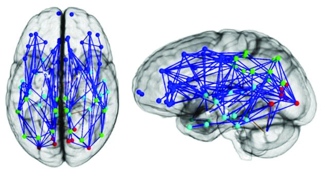 Men and women’s brains are wired differently