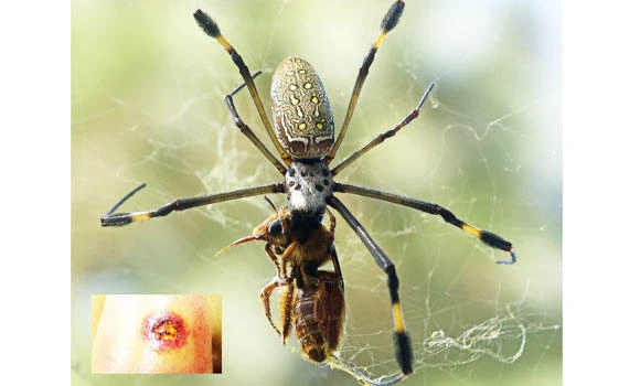 Hospitals lack antidote for spider venom