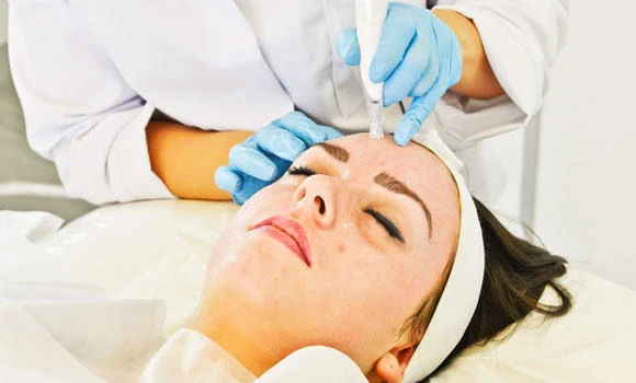 Meso C facial for smooth young skin