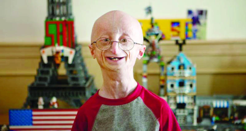 US boy whose premature aging inspired film dies
