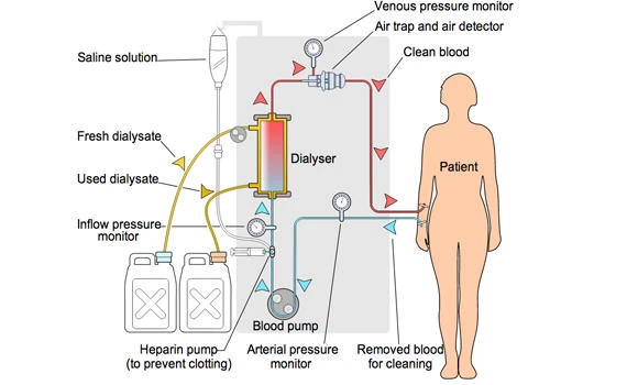 SR400m program to serve 5,000 renal patients — including expats