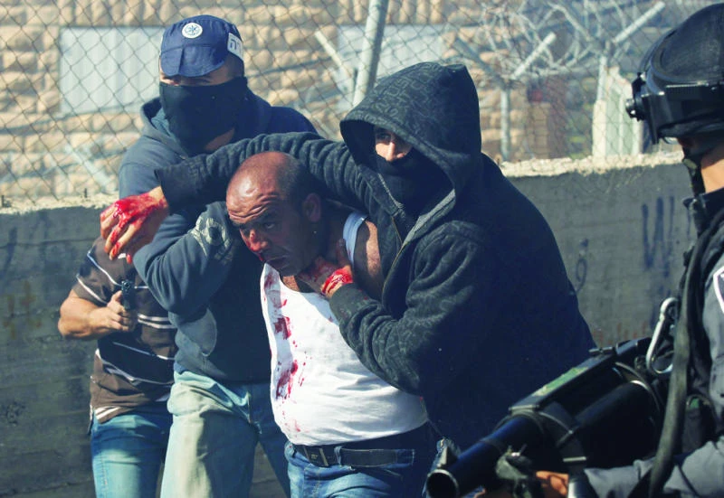 Five Palestinians hurt as Israelis fire on protesters
