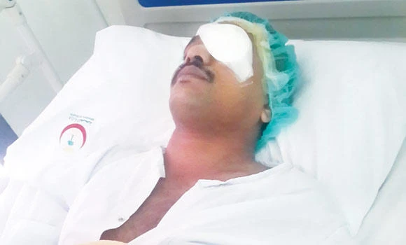 Indian worker in Abqaiq hurt in attack