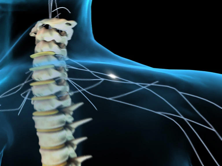 Traffic accidents account for 61% of spinal cord injuries
