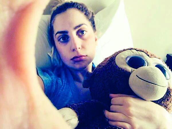 Sad selfie: Lady Gaga has wisdom teeth pulled