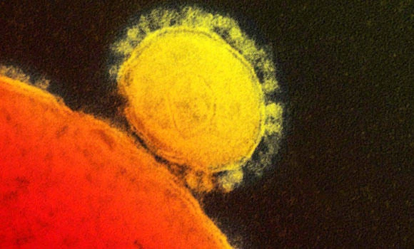 1 life lost; 14 affected by MERS