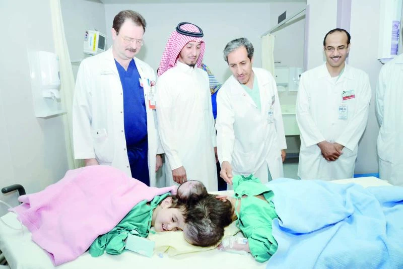 Saudi twins separated in marathon surgery