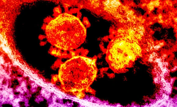 MERS not a global threat, says report