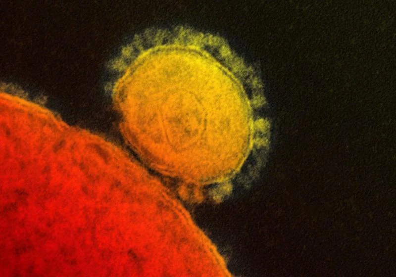 First US case of deadly MERS virus confirmed: CDC