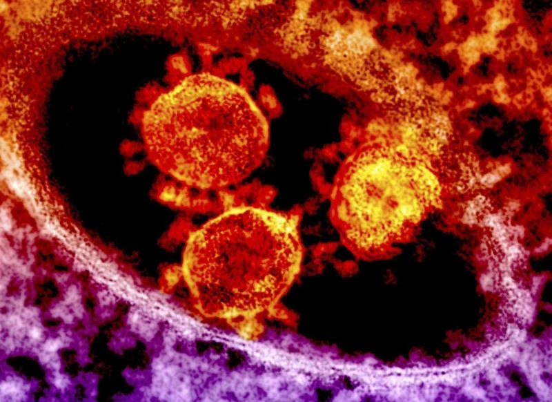 Anti-MERS trial vaccine raises hopes