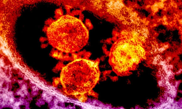 New MERS death in Jordan