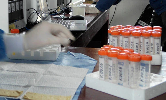 Shortage of BCG vaccine looms