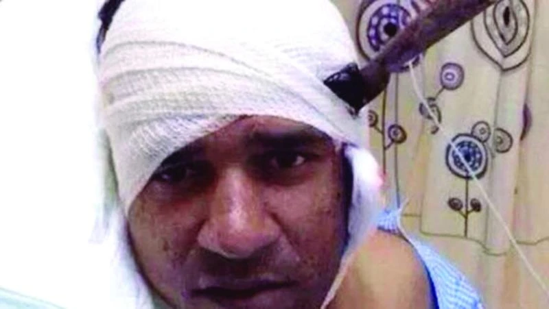 Expat survives stabbing with knife still in head