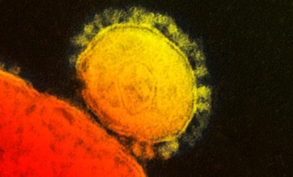 1st MERS casualty reported in Oman