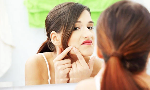 Treating acne during pregnancy