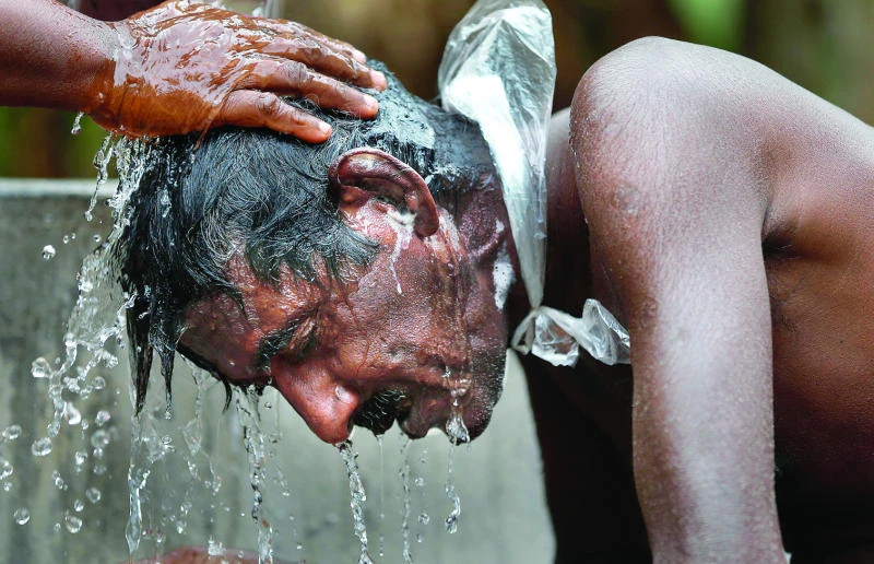 Mystery kidney disease killing Sri Lankan farmers