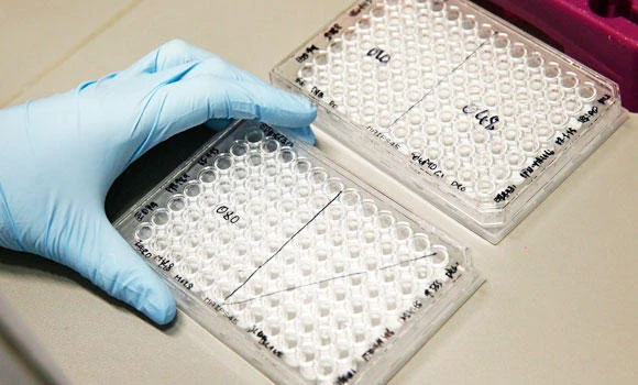 UN needs final $1bn to fight Ebola