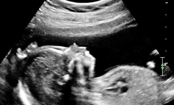 Pregnant? 10 symptoms and their treatments