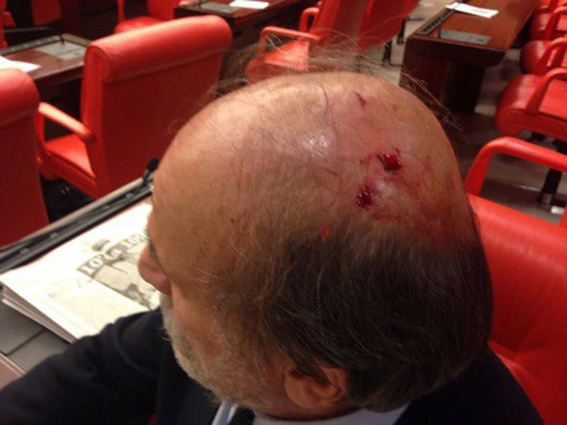More violence erupts in Turkey’s Parliament
