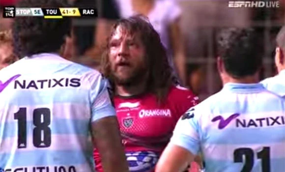 Annoyed dog bites nose of playful rugby player