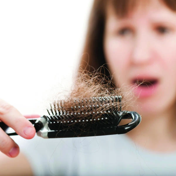 All you need to know about hair loss