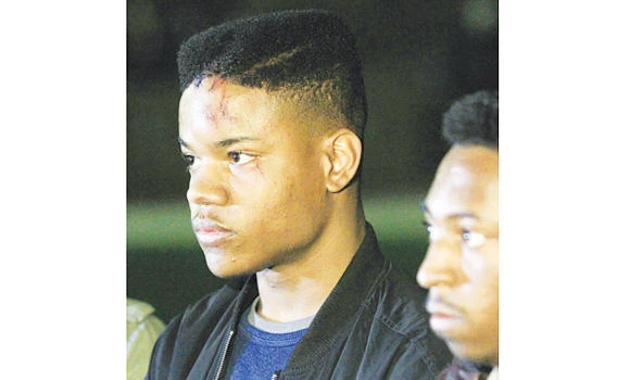 Black hurt by white police sparks fresh US race debate