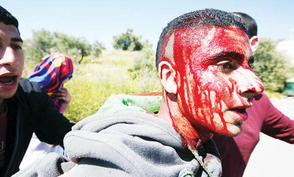 Teenager’s killing ‘emphasizes ugliness of Zionist occupation’
