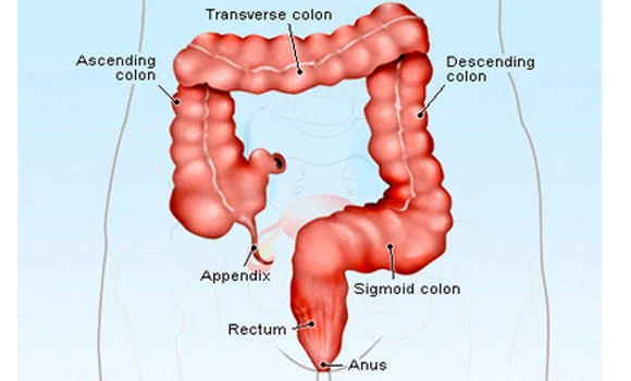 Need for early detection of colorectal cancer urged