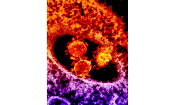Najran man dies of MERS; two new cases