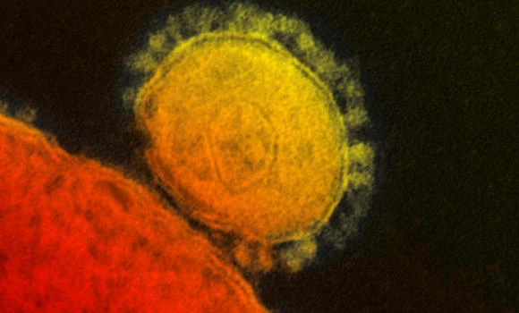 Saudi man dies of MERS; 9 new cases
