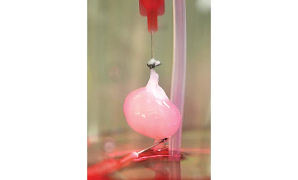 15,000 renal failure cases reported in KSA