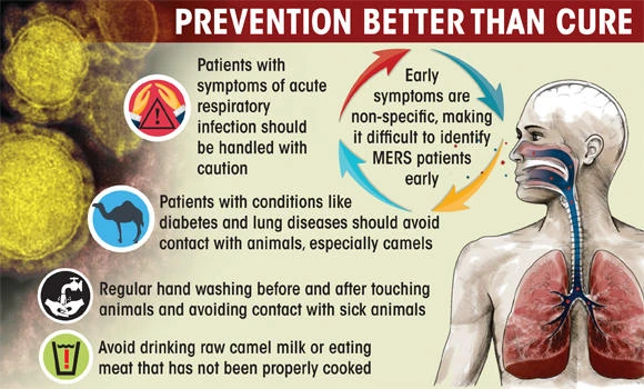 Two women succumb to MERS; caution urged