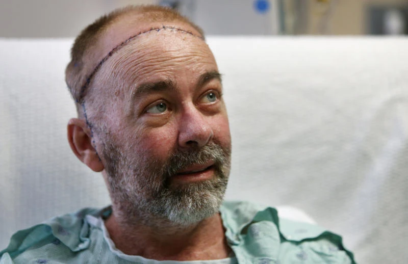 US doctors perform groundbreaking skull-scalp transplant