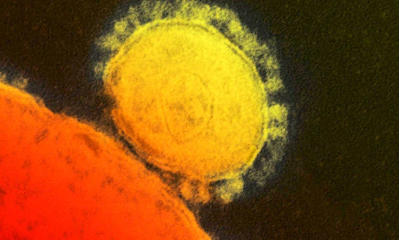 MERS kills one, infects 2