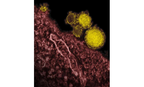 Mother dies of MERS, 3 of family infected