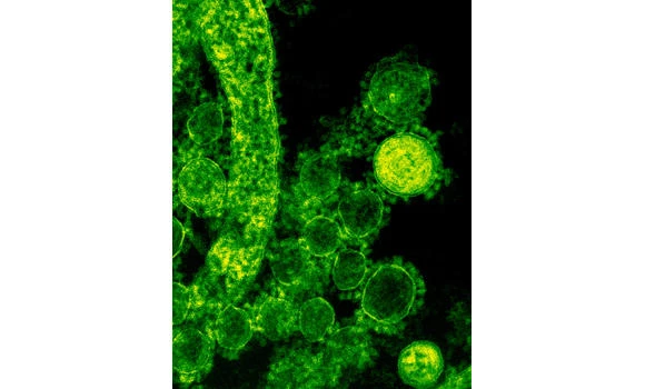 Man dies, 3 women contract MERS