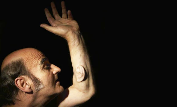 Aussie artist to connect ‘ear’ on arm to web