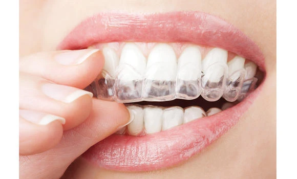 For a whiter, brighter smile