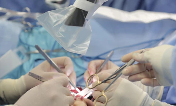 Yemeni undergoes successful complicated cosmetic surgery