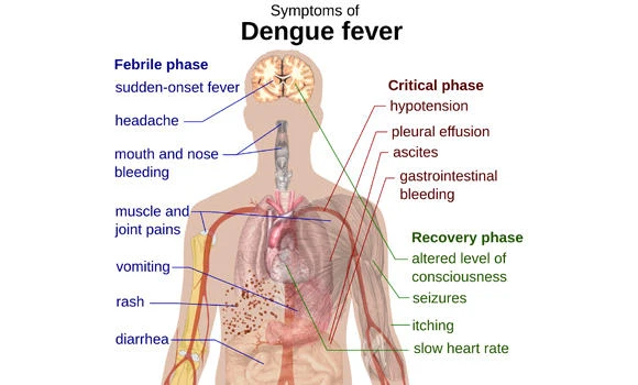 Dengue cases drop in Jeddah