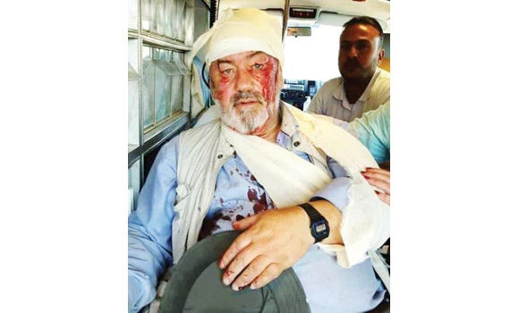 Zionist landgrabbers savage UK activist, burn Palestinian land
