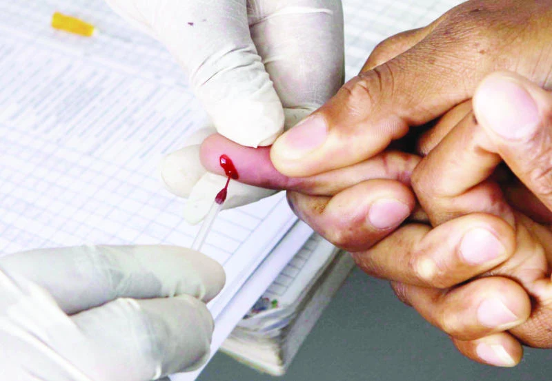 HIV patients should start treatment immediately