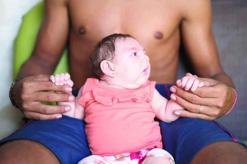 Brazil fears birth defects linked to mosquito-borne virus