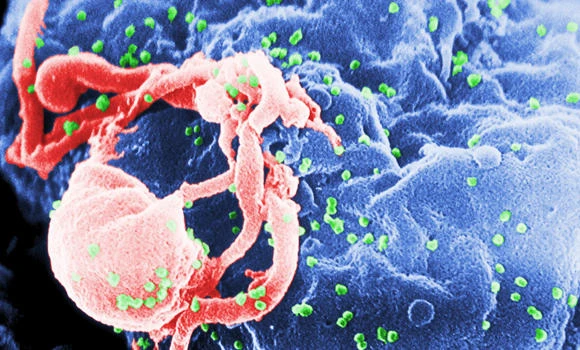 HIV deaths feared as Manila cuts funding on contraception