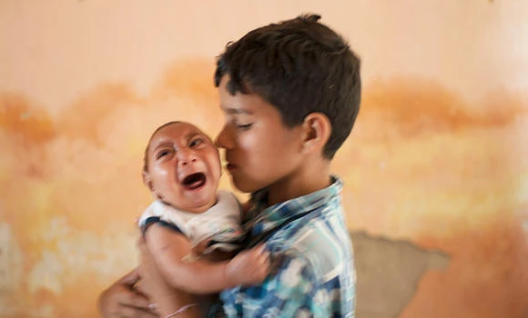 Baby born in Hawaii with brain damage confirmed to have Zika infection
