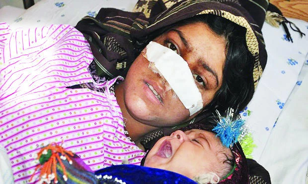 Hunt on for Afghan man who cut off wife’s nose
