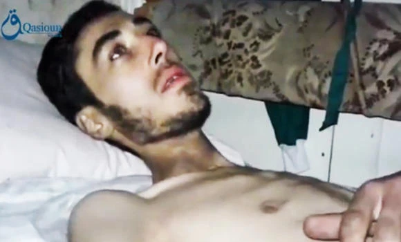 Madaya: Starvation kills 16 more
